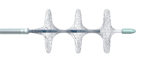 國內(nèi)首創(chuàng)！本市研發(fā)生產(chǎn)的1款Ⅲ類創(chuàng)新醫(yī)療器械獲批上市，為具有溶栓禁忌癥的患者提供了治療選擇